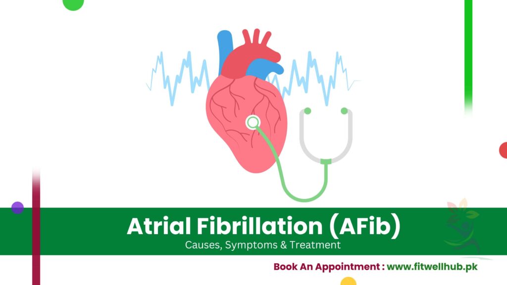 ECG showing irregular heartbeat patterns associated with Atrial Fibrillation (AFib)