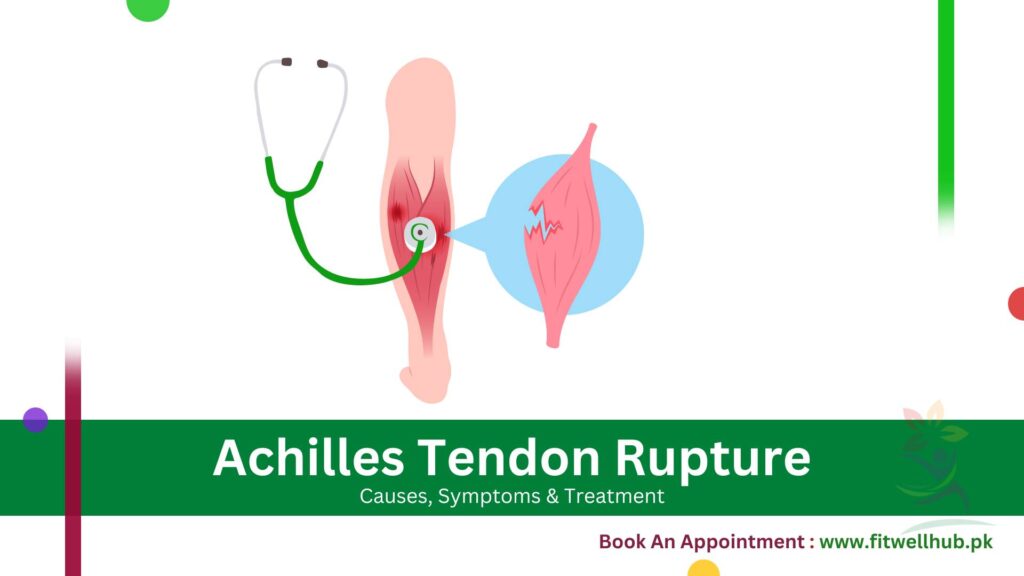 Tendon rupture illustration